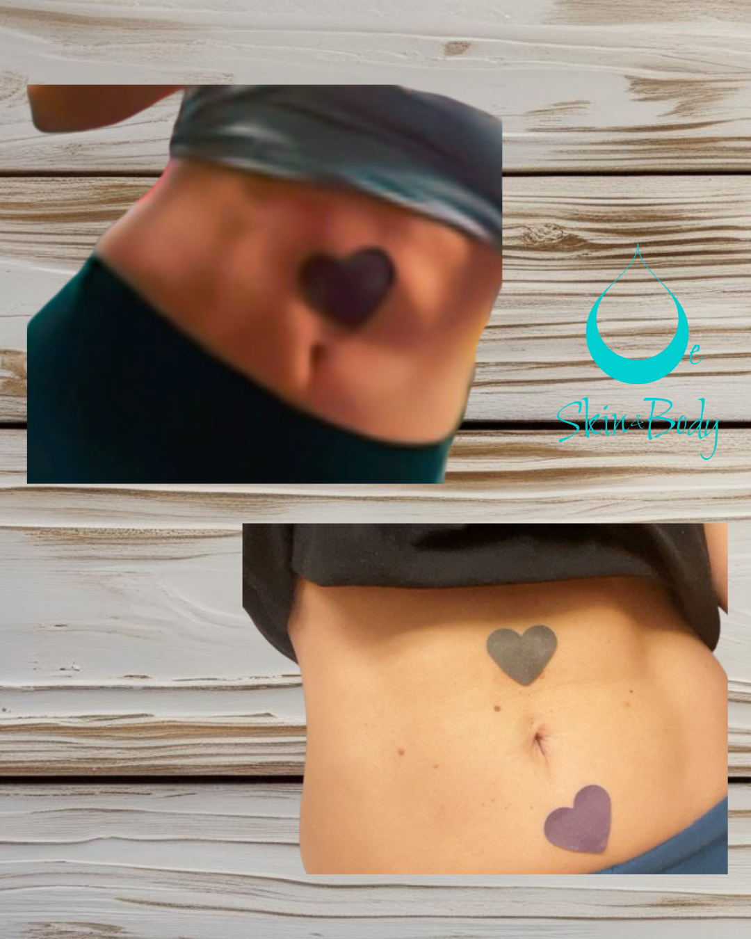 OeSkin Magnetic Patches – Hearts & Stars Edition